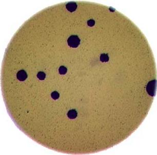Image of bacteria colonies in a petri dish